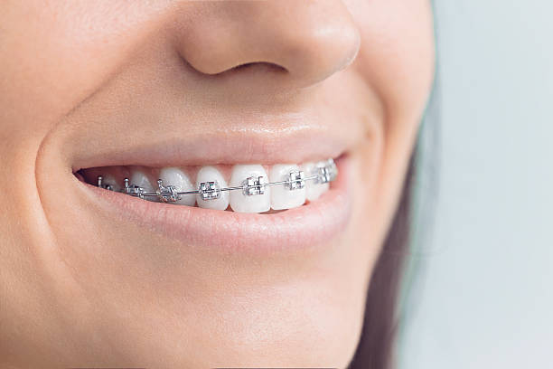 Best Dental Inlays and Onlays  in Toppers, OK